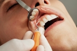 Healthwatch Survey on Dental Services